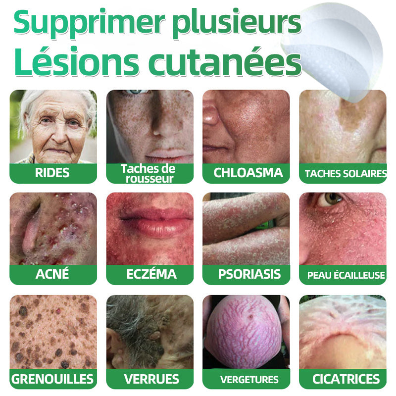 👉80% DE RÉDUCTION 🔥Hudros® Patch 2-en-1 à Micro-Aiguilles & Hydrocolloïde | Aide à Réduire l’Apparence de l’Acné, des Verrues Plates et des Acrochordons | Patchs Invisibles pour le Visage et le Corps | 144 Pièces 🔥