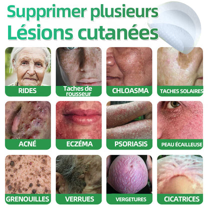 👉80% DE RÉDUCTION 🔥Hudros® Patch 2-en-1 à Micro-Aiguilles & Hydrocolloïde | Aide à Réduire l’Apparence de l’Acné, des Verrues Plates et des Acrochordons | Patchs Invisibles pour le Visage et le Corps | 144 Pièces 🔥