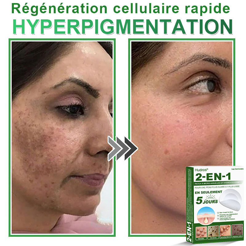 👉80% DE RÉDUCTION 🔥Hudros® Patch 2-en-1 à Micro-Aiguilles & Hydrocolloïde | Aide à Réduire l’Apparence de l’Acné, des Verrues Plates et des Acrochordons | Patchs Invisibles pour le Visage et le Corps | 144 Pièces 🔥