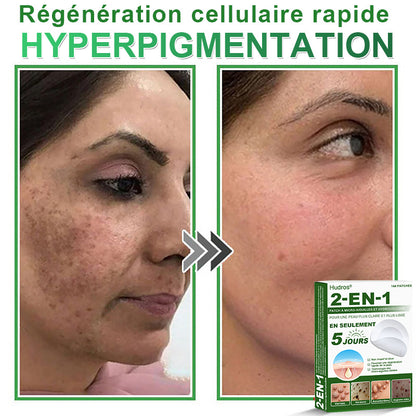 👉80% DE RÉDUCTION 🔥Hudros® Patch 2-en-1 à Micro-Aiguilles & Hydrocolloïde | Aide à Réduire l’Apparence de l’Acné, des Verrues Plates et des Acrochordons | Patchs Invisibles pour le Visage et le Corps | 144 Pièces 🔥