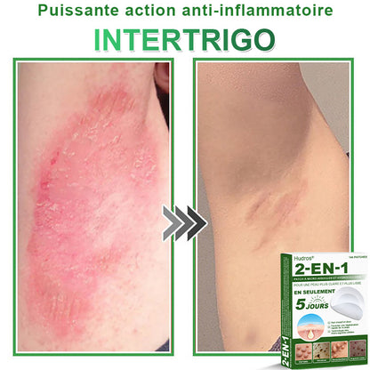 👉80% DE RÉDUCTION 🔥Hudros® Patch 2-en-1 à Micro-Aiguilles & Hydrocolloïde | Aide à Réduire l’Apparence de l’Acné, des Verrues Plates et des Acrochordons | Patchs Invisibles pour le Visage et le Corps | 144 Pièces 🔥
